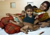 Vishnu Baby Goes Under the Knife