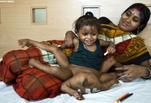 Vishnu Baby Goes Under the Knife