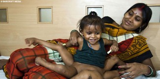 Vishnu Baby Goes Under the Knife