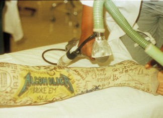 Harald Oimoen’s Shattered Leg in the Front Row